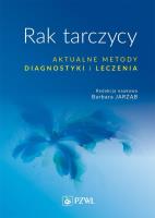Rak tarczycy Aktualne metody diagnostyki i leczenia. Autor: Barbara Jarząbska-. SmakLiter.pl Okładka książki Rak tarczycy Aktualne metody diagnostyki i leczenia