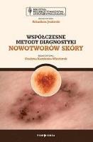 Okładka książki Współczesne metody diagnostyki nowotworów skóry